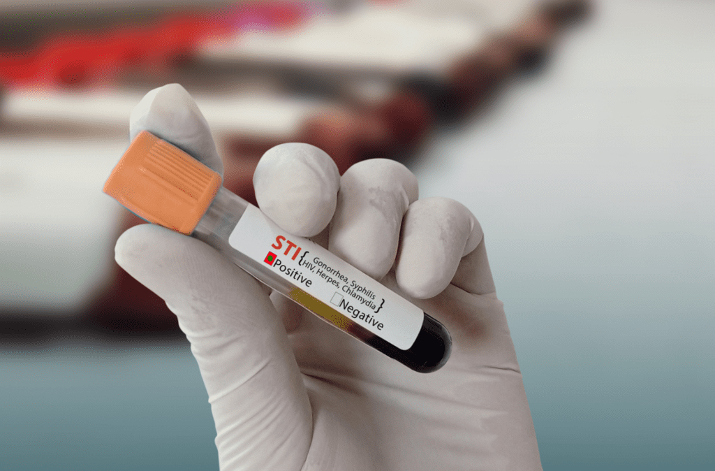STI Testing